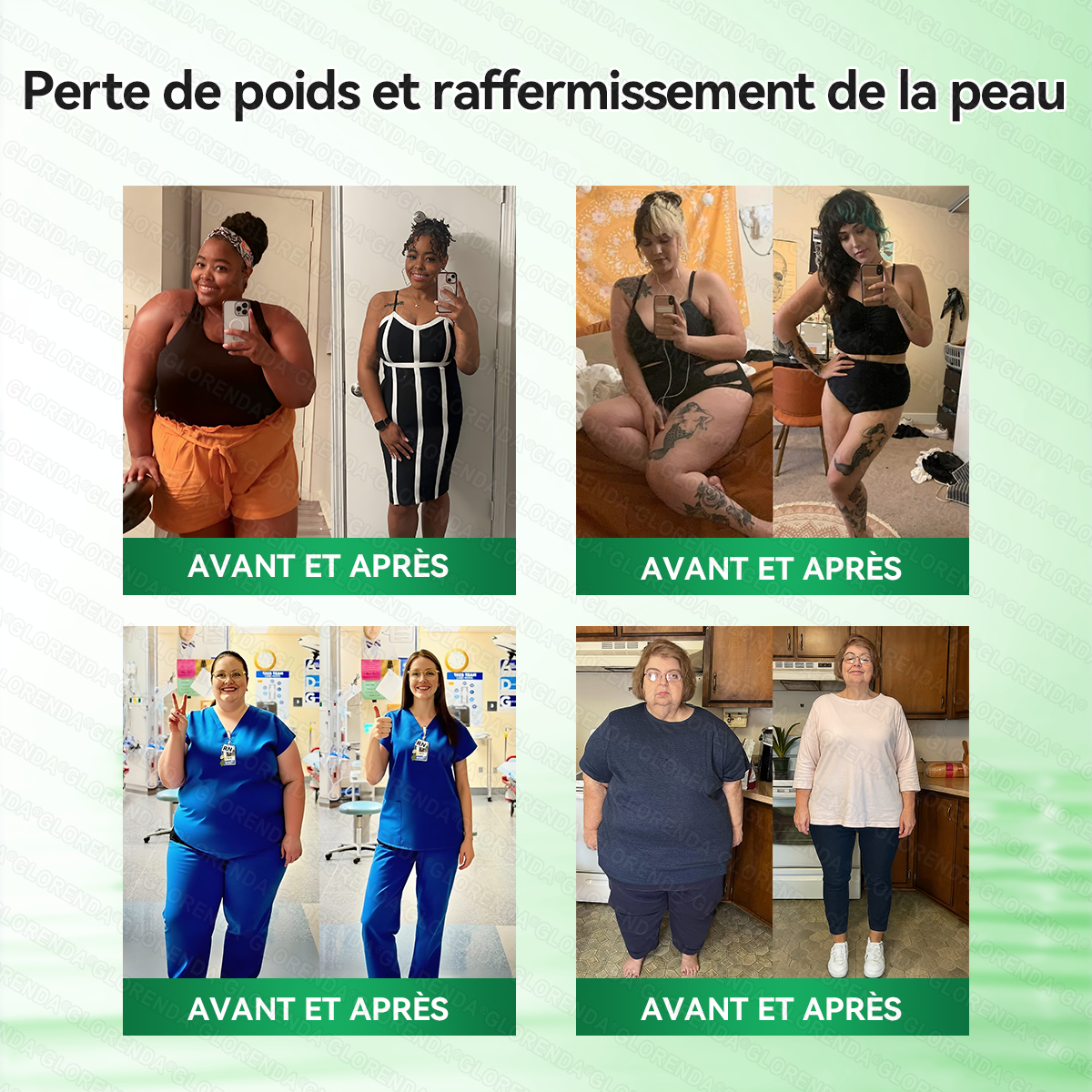 Boutique officielle 🌈🌈𝐆𝐋𝐎𝐑𝐄𝐍𝐃𝐀® Moringa · Berbérine + NAD+ – Patch Microneedle Nano Avancé 10-en-1 (1×/jour, résultats visibles en 7 jours) | Gestion du poids, relâchement cutané, sommeil, articulations, etc.